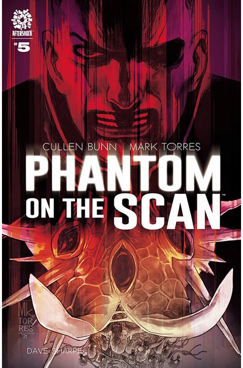 Phantom On Scan #5